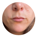 Dermatología clínica