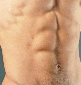 Tonificación Muscular