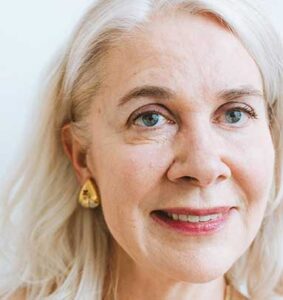 Blefaroplastia láser